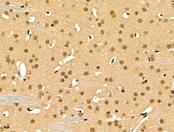 Invitrogen EZH1 Polyclonal Antibody 100 &mu;L; Unconjugated:Antibodies,