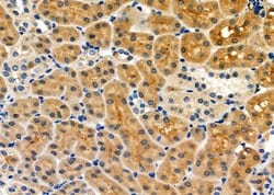 Invitrogen FASTKD5 Polyclonal Antibody 100 &mu;L; Unconjugated:Antibodies,