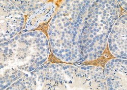 Invitrogen FASTKD5 Polyclonal Antibody 100 &mu;L; Unconjugated:Antibodies,