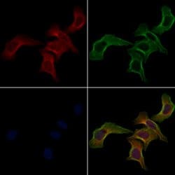 Invitrogen FAS (CD95) Polyclonal Antibody 100 &mu;L; Unconjugated:Antibodies,