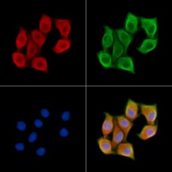 Invitrogen Myosin Heavy Chain Polyclonal Antibody 100 &mu;L; Unconjugated:Antibodies,