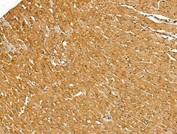 Invitrogen Myosin Heavy Chain Polyclonal Antibody 100 &mu;L; Unconjugated:Antibodies,