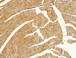 Invitrogen Myosin Heavy Chain Polyclonal Antibody 100 &mu;L; Unconjugated:Antibodies,
