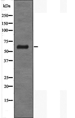 Invitrogen CD89 Polyclonal Antibody 100 &mu;L; Unconjugated:Antibodies,