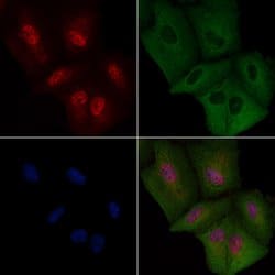 Invitrogen FGF1 Polyclonal Antibody 100 &mu;L; Unconjugated:Antibodies,
