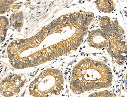 Invitrogen FGF1 Polyclonal Antibody 100 &mu;L; Unconjugated:Antibodies,