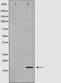 Invitrogen FGF1 Polyclonal Antibody 100 &mu;L; Unconjugated:Antibodies,