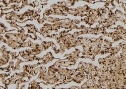 Invitrogen FGF2 Polyclonal Antibody 100 &mu;L | Buy Online | Invitrogen&trade; | Fisher Scientific