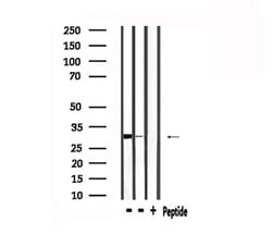 Invitrogen FGF2 Polyclonal Antibody 100 &mu;L | Buy Online | Invitrogen&trade; | Fisher Scientific