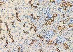 Invitrogen FGF21 Polyclonal Antibody 100 &mu;L; Unconjugated:Antibodies,