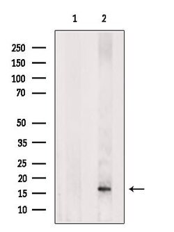 Invitrogen FGF21 Polyclonal Antibody 100 &mu;L; Unconjugated:Antibodies,