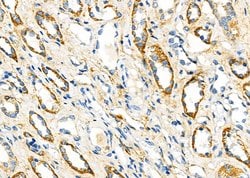 Invitrogen FGF4 Polyclonal Antibody 100 &mu;L; Unconjugated:Antibodies,