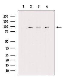 FGFR1/FGFR2 Polyclonal Antibody 100 &mu;L | Buy Online | Thermo Scientific | Fisher Scientific