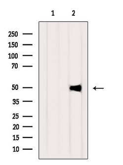 Invitrogen FGL2 Polyclonal Antibody 100 &mu;L | Buy Online | Invitrogen&trade; | Fisher Scientific