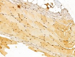Invitrogen FHL2 Polyclonal Antibody 100 &mu;L; Unconjugated:Antibodies,