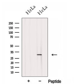 Invitrogen FHL2 Polyclonal Antibody 100 &mu;L; Unconjugated:Antibodies,