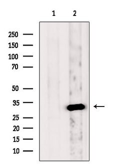 Invitrogen FHL2 Polyclonal Antibody 100 &mu;L; Unconjugated:Antibodies,
