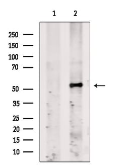 Invitrogen Fibromodulin Polyclonal Antibody 100 &mu;L; Unconjugated:Antibodies,