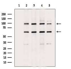 Invitrogen Filaggrin Polyclonal Antibody 100 μL; Unconjugated:Antibodies,