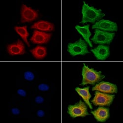 Invitrogen Filaggrin Polyclonal Antibody 100 μL; Unconjugated:Antibodies,