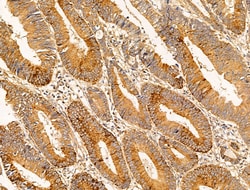 Invitrogen Filaggrin Polyclonal Antibody 100 μL; Unconjugated:Antibodies,
