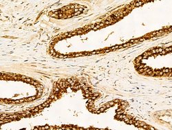 Invitrogen Filaggrin Polyclonal Antibody 100 μL; Unconjugated:Antibodies,