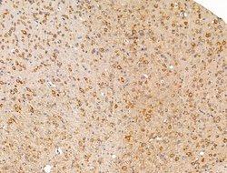 Invitrogen FKBP3 Polyclonal Antibody 100 &mu;L; Unconjugated:Antibodies,