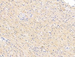 Invitrogen FKBP3 Polyclonal Antibody 100 &mu;L; Unconjugated:Antibodies,