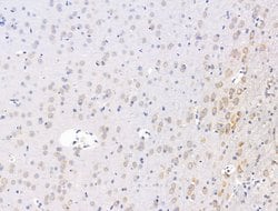 Invitrogen FKBP3 Polyclonal Antibody 100 &mu;L; Unconjugated:Antibodies,
