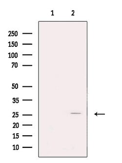 Invitrogen FKBP3 Polyclonal Antibody 100 &mu;L; Unconjugated:Antibodies,