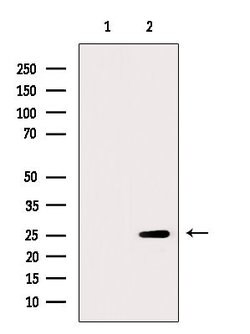 Invitrogen FKBP3 Polyclonal Antibody 100 &mu;L; Unconjugated:Antibodies,