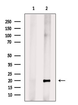 Invitrogen SEM1 isoform 2 Polyclonal Antibody 100 &mu;L; Unconjugated:Antibodies,