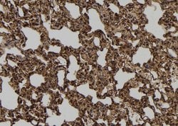 FMRP Polyclonal Antibody:Antibodies, Polyclonal