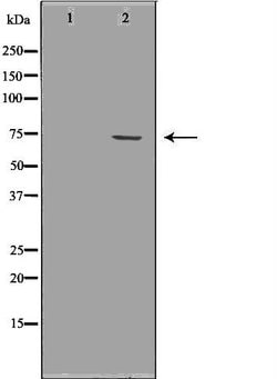 FMRP Polyclonal Antibody:Antibodies, Polyclonal