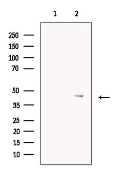 Invitrogen FOXF1 Polyclonal Antibody 100 &mu;L; Unconjugated:Antibodies,