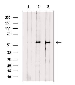 Invitrogen FOXF1 Polyclonal Antibody 100 &mu;L; Unconjugated:Antibodies,