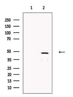 Invitrogen FOXF2 Polyclonal Antibody 100 &mu;L | Buy Online | Invitrogen&trade; | Fisher Scientific