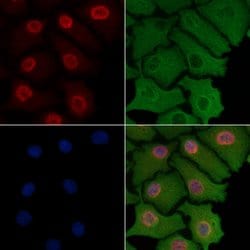Invitrogen FOXK1 Polyclonal Antibody 100 &mu;L; Unconjugated:Antibodies,