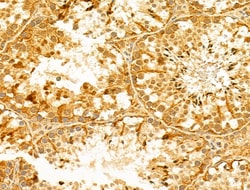 Invitrogen FOXR2 Polyclonal Antibody 100 μL; Unconjugated:Antibodies,