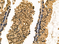 Invitrogen Fra1 Polyclonal Antibody 100 &mu;L; Unconjugated:Antibodies,