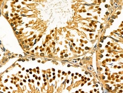 Invitrogen Fra1 Polyclonal Antibody 100 &mu;L; Unconjugated:Antibodies,