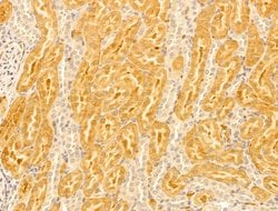 Invitrogen FTCD Polyclonal Antibody 100 &mu;L; Unconjugated:Antibodies,
