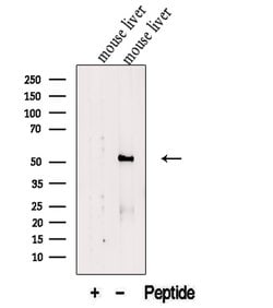 Invitrogen FTCD Polyclonal Antibody 100 &mu;L; Unconjugated:Antibodies,