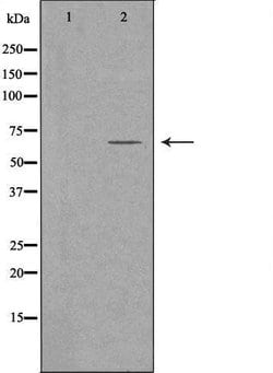 Invitrogen FZD9 Polyclonal Antibody 100 μL; Unconjugated:Antibodies,