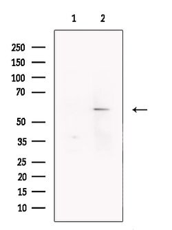 GABRB3 Polyclonal Antibody:Antibodies, Polyclonal