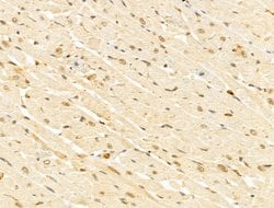 Invitrogen GABPB1 Polyclonal Antibody 100 &mu;L; Unconjugated:Antibodies,