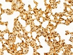 Invitrogen GABPB1 Polyclonal Antibody 100 &mu;L; Unconjugated:Antibodies,