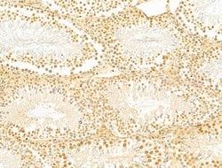Invitrogen GABPB1 Polyclonal Antibody 100 &mu;L; Unconjugated:Antibodies,