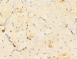 Invitrogen GABPB1 Polyclonal Antibody 100 &mu;L; Unconjugated:Antibodies,