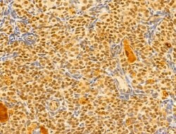 Invitrogen GABPB1 Polyclonal Antibody 100 &mu;L; Unconjugated:Antibodies,